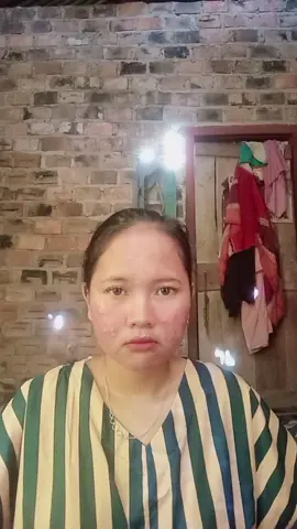 tetep ms glow  @Shandypurnamasary  #fypシ゚ #fypage #foryoupage #fypシ゚viral #fypppppppppppppppppppppppppppppppppppp 
