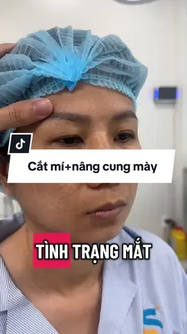 Mỗi người có tình trạng khác nhau vì vậy BS cũng có các phương pháp can thiệp khác nhau #bsthechuyen #pttm #lamdep #phunu #catmi #nangcungmay #nangcungchanmayrutchi #xh 