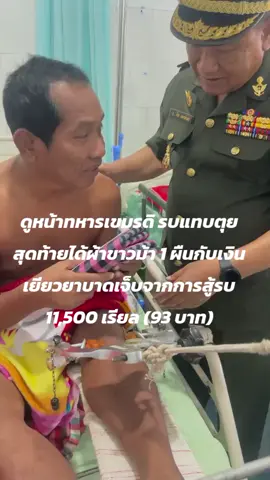 ดูหน้าทหารเขมรดิ รบแทบตุย สุดท้ายได้ผ้าขาวม้า 1 ผืนกับเงินเยียวยาบาดเจ็บจากการสู้รบ 11,500 เรียล (93 บาท)