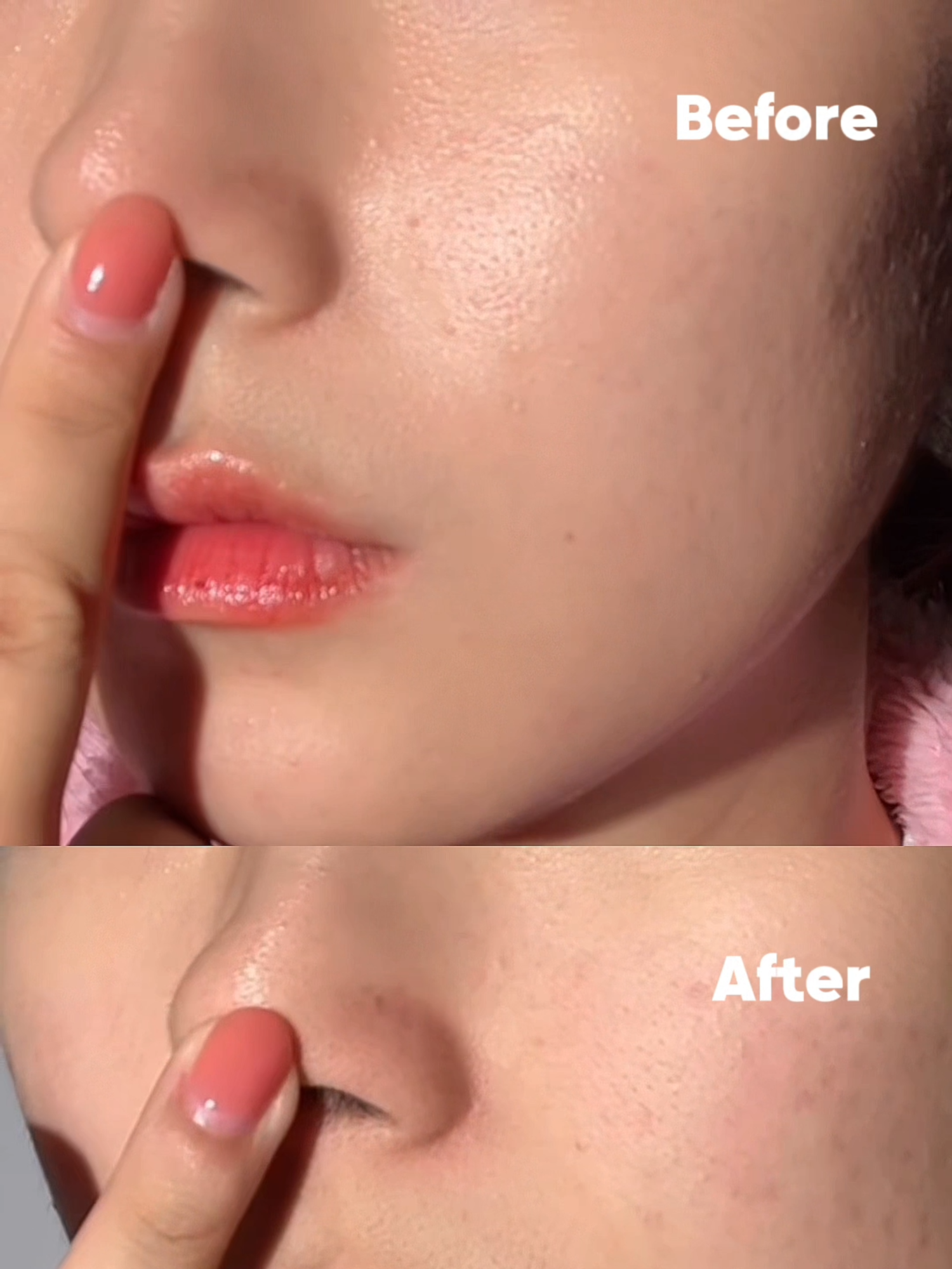 Why use Guava Pore Cleansing Oil? 🍈 #benton #doublecleansing #cleansingoil #cleansingoilrecommendation #enlargedpores #cloggedpores #sebaceousfilament #porecare #porecleansing #guava #guavaporecleansingoil #makeupreadyskin #makeupprep
