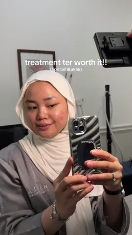 AAA tiap ngaca bener-bener mikir ke diri sendiri emang worth it rutin treatment 😭 glowing nya beda 