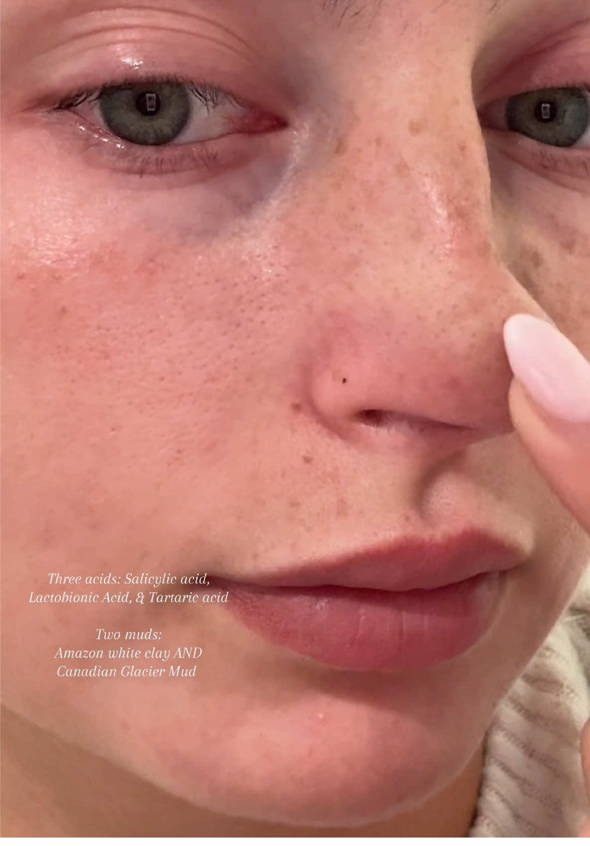 Absolutely amazed with the results after one day & for the price?!?🤯 @Dr.Leo-USA #skincare #pores #viral #drleo #glassskin 