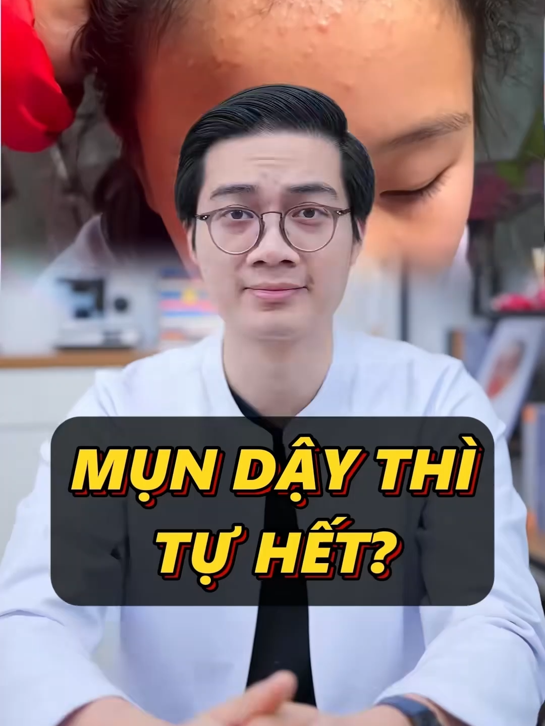 sữa rửa mặt 88 cải thiện làn da hiệu quả sau 1-2 tuần nhìn mê lắm luôn