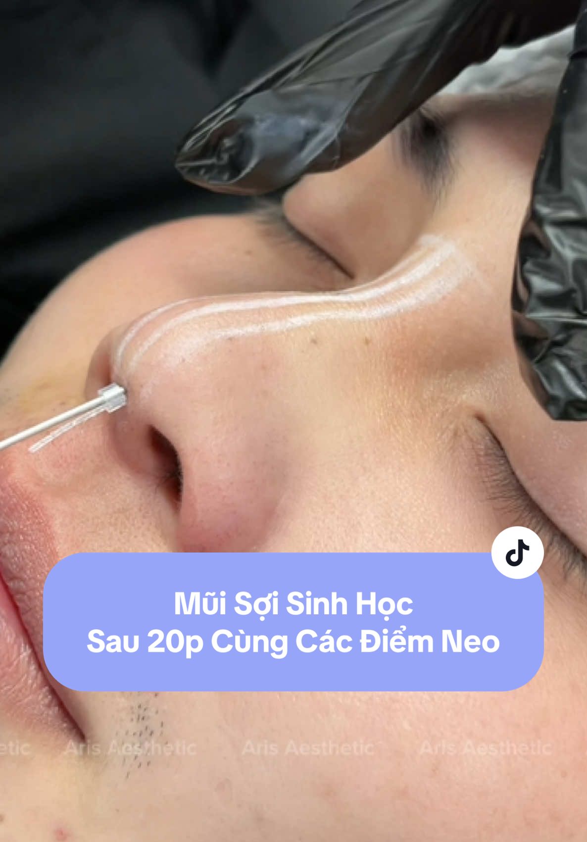 Không da o kéo làm nhanh chỉ 20p mà có ngay sống mũi đẹp #lamdep #xuhuong #muichi #nangmui 