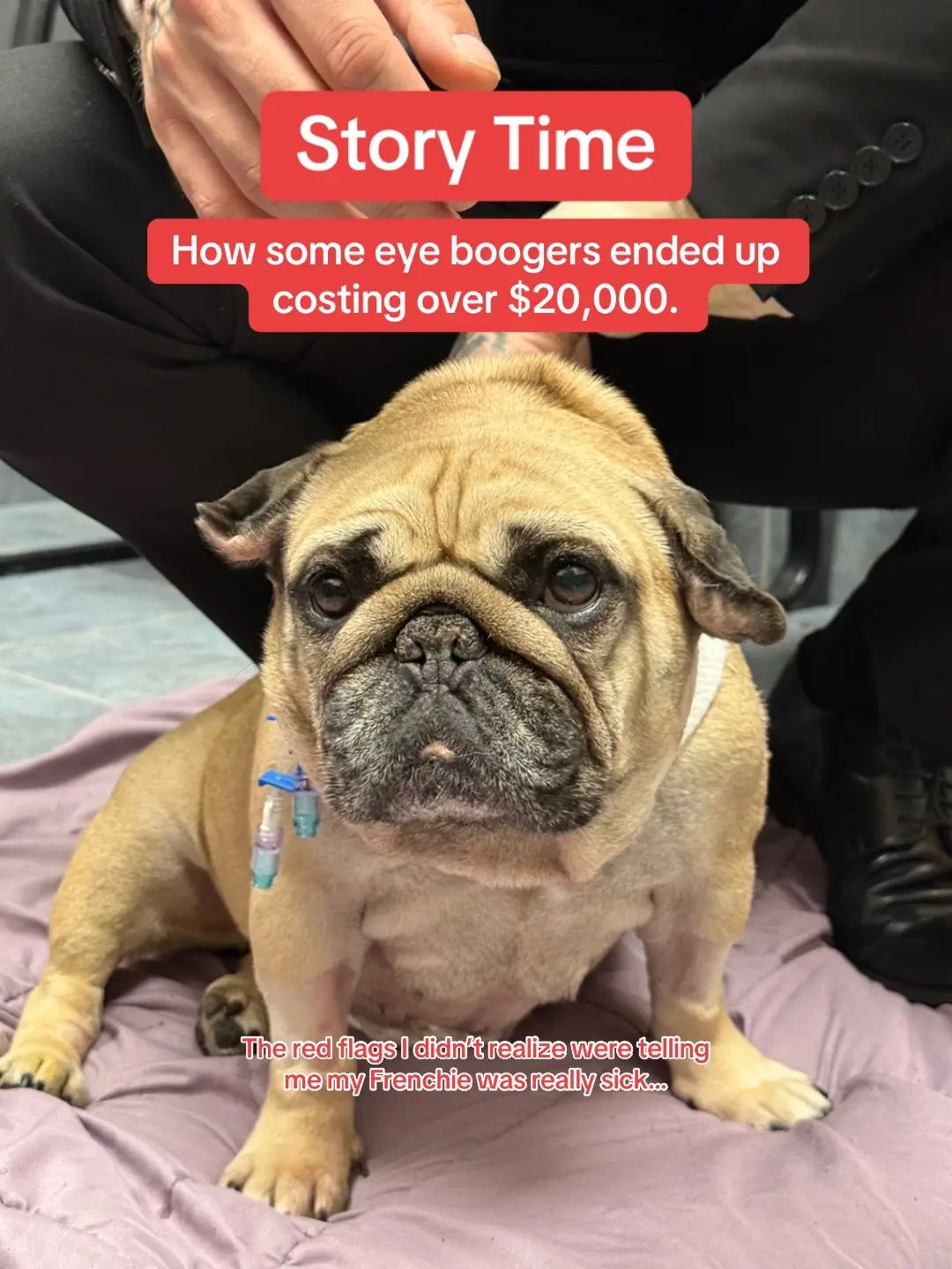 This is the story time of how we found out our Frenchie was sick. What started as something that seemed so small turned into the scariest and most expensive journey we have ever been through with her. It began with a little bit of eye discharge, nothing that felt like a big deal at first. We brought her to the vet just to be safe and were told she looked pretty healthy overall. They ran a blood test and when the results came back her white blood cells were very high. That led to a urine test which showed protein and raised concern about possible kidney issues. We booked an ultrasound with a specialist but the earliest appointment was almost a week away. In the meantime her symptoms grew worse. She became so lethargic that she stopped following me from room to room, something she had never done before. She lost interest in food, started drinking water endlessly, and even peed herself in front of me which had never happened. One day at the dog park she actually laid down in the middle of play, something I had never seen in her. I remember sitting there thinking is something seriously wrong or am I just overreacting. By the time we got to the emergency vet they admitted her immediately. They told us things were serious and kept her overnight in case she needed a transfusion. After more testing the next morning they discovered a mass on her liver and based on her CT scan they recommended emergency surgery right away. During surgery they were able to remove about 90 percent of the mass. The surgeons believe it is cancer but we are still waiting on the results to know exactly what type. Right now what matters most is that she made it through and she is doing well in her recovery. What started as just some eye boogers ended up costing over twenty thousand dollars and nearly cost her life. I wanted to share this story so other pet parents know the warning signs to never ignore. #sickdog #gofundme #donate #frenchbulldog #frenchie 