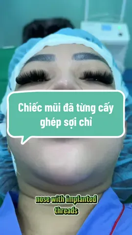 remove implant and nose lift #xuhuong #dr #tiktok #lamdep #indonesia 