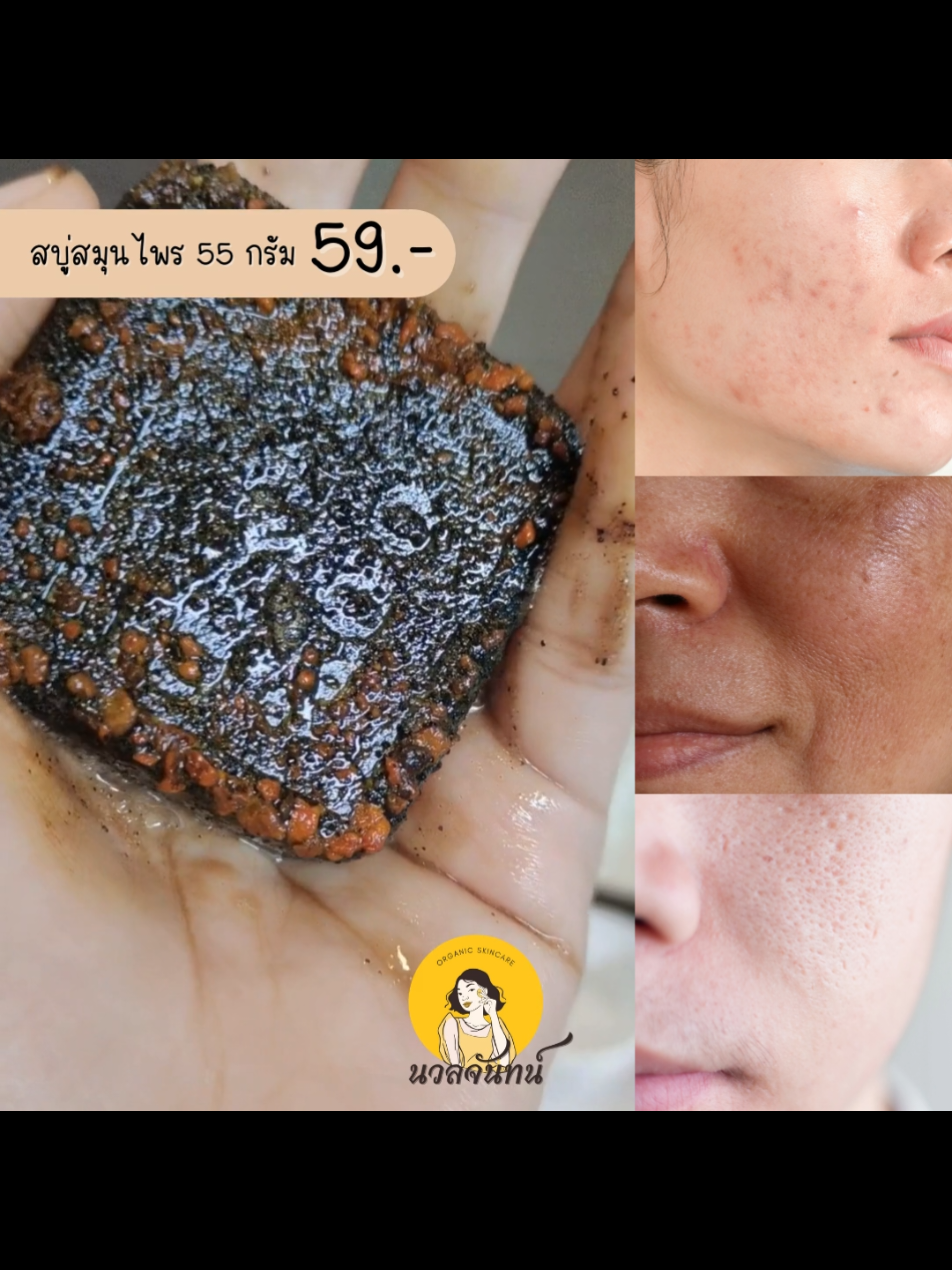 👍ราคาจิ๊บๆคุณภาพคับก้อน😲 #สบู่นวลจันทน์ #ลดสิว #ผิวกระจ่างใส #ผิวลื่นละเอียด #ผลัดเซลล์ผิวเก่าเผยผิวใหม่ 