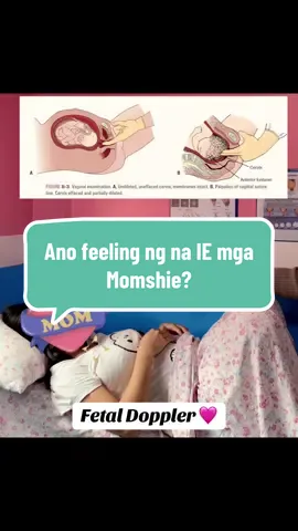 Dalawang Daliri lang po ang pinapasok namin kapag nag IE mga momshie ah ✌🏼 #NurseMidwifeDonnamae #DonnamaePaanakan #fetaldoppler #internalexamination 