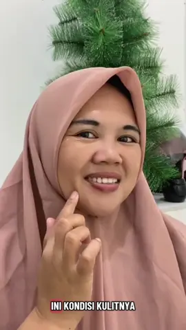 moisturizer chalonese memvbantu kamu mencerahkan flekk hitam dan menghilangkan bekas jerawat dimuka kamu💞🤗#fypppppppppppppppppppppppp #skincaretips #ForYourBeauty #skincareroutine #viralvideo #awetmudayuk #chalonese #skincareviral #chaloneseskincare #wajahmulus #glowingskin #kusama #glowingmaksimal #PromoCantik #rekomendasiskincare #promocuan #kerutan #bpomdanhalal✅ #bumildanbusui #hydrateskincare