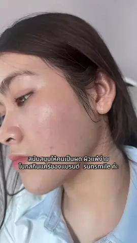 169.- ตอน 18:50 #sunsamile #เซรั่มลูกคุณหนู🐰 #169 #ฟีดดดシ 