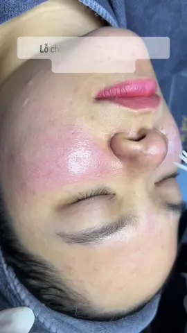 Mê lắm, thích sự phấn phấn nhẹ nhàng này, cải thiện da siêu hiệu quả nếu các bạn làm đúng kỹ thuật nha. 28/8 khoá hỗ trợ peel tiếp theo, học kỹ nhé. Các bạn ib đky suất 399-499k #daypeeldakhoahoc #chemicalpeel #hocpeelda #daotaospa #peeltca 