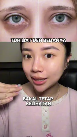 emang mata se pengaruh itu sih, kalo fresh pasti keliatan cakeppp 🥹🫶🏻 #eyecream 
