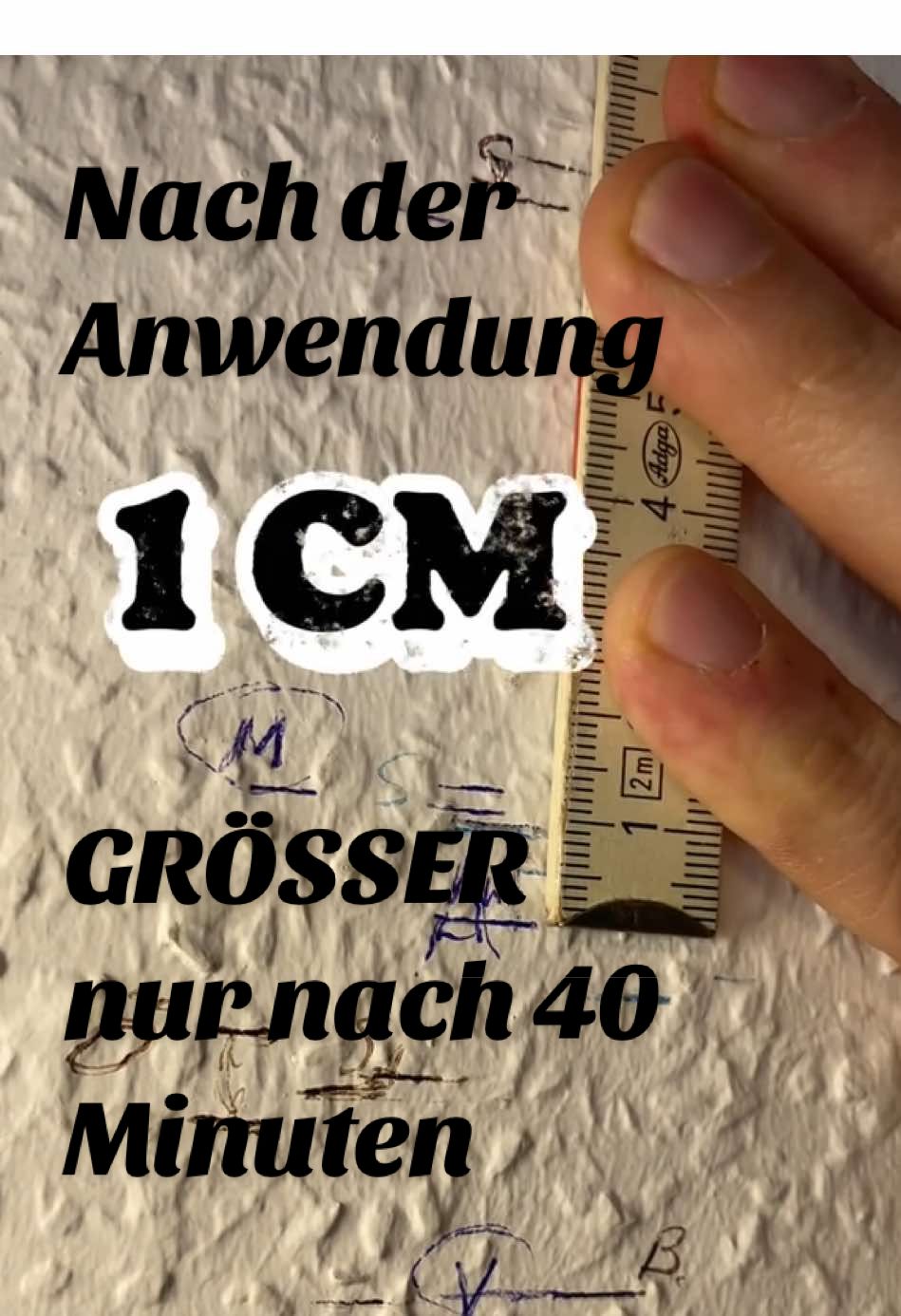 Vorher–Nachher-Messung: +1 cm Körpergröße! Nach nur 36,5 Minuten war unsere Kundin einen Zentimeter größer. Was steckt dahinter? 👉 Die Wirbelsäule wird sanft gestreckt – das kann mehr Raum für Bandscheiben und Spinalnerven schaffen. Ein spürbarer Impuls zur Entlastung der Bandscheiben und des Rückens. Kein Zauber, sondern eine medizinische Therapieliege. ✨ 📍 Teste es selbst: CERAGEM Testcenter Gelsenkirchen 📍 Bismarckstraße 119 📞 0209 389 777 97 👉 Jetzt Termin vereinbaren und Wirkung erleben! #ceragem #wirbelsäule #bandscheiben #gelsenkirchen #baldohnerückenschmerzen  