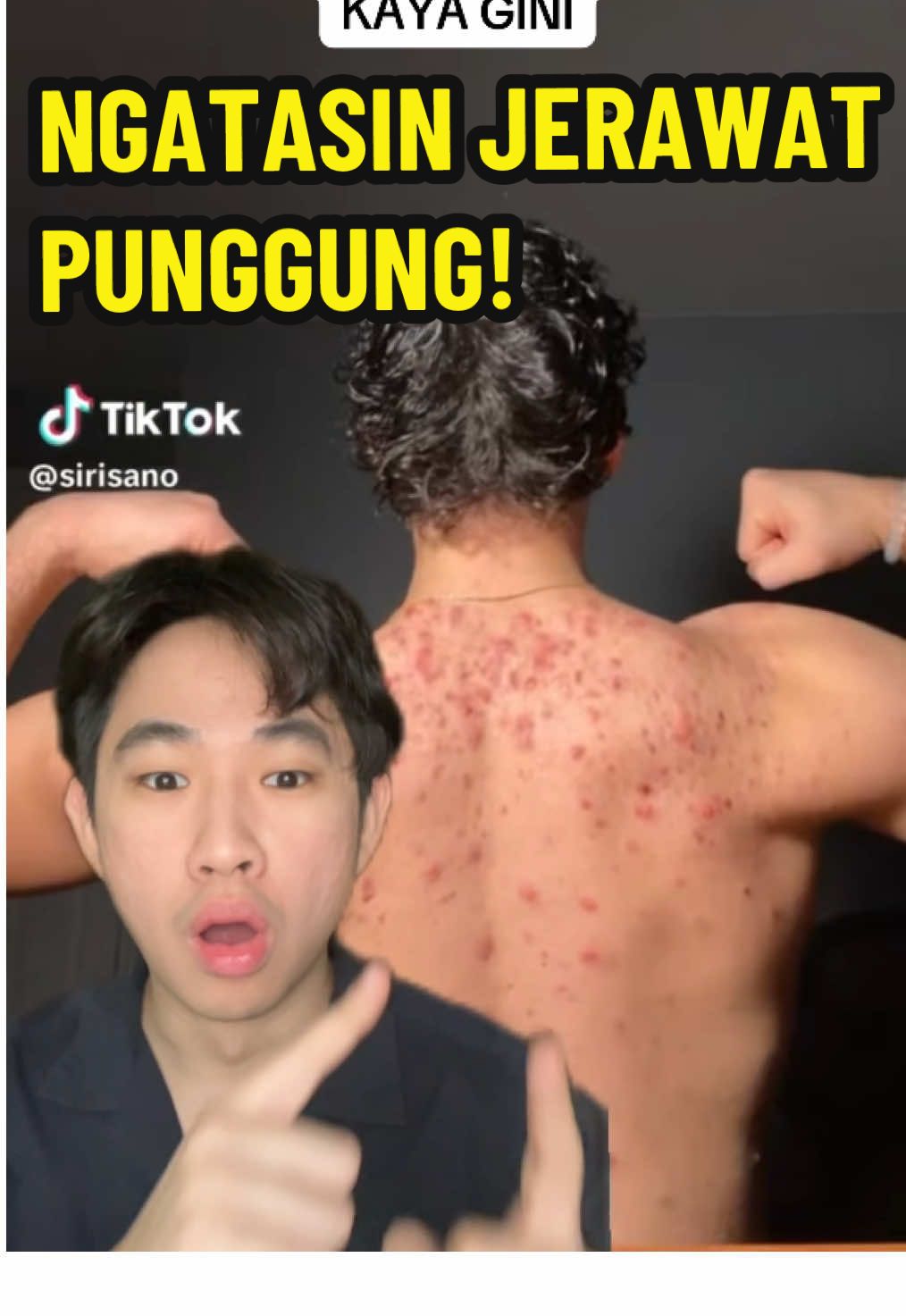 Sabun badan untuk jerawat, pake rutin ya supaya mengurangi jerawat di badan/ punggung #kokohskincare #greenscreenvideo #acnebaracnaway 