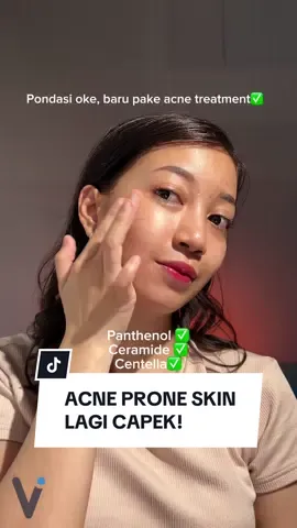 acne prone skin lagi capek jerawat ga sembuh2! ternyata skin barrier aku RUSAK guys😮‍💨 jadi harus benerin pondasi dulu pake Ceramide/panthenol/centella #fyp #acneprone #ceramide #panthenol #jeratjerawat 