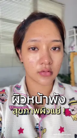 #MelaZincAC #MelaZincACรีวิว #เม็ดเคี้ยวMela #อาหารเสริมลดสิว #ช้อปติดเทรนด์ 