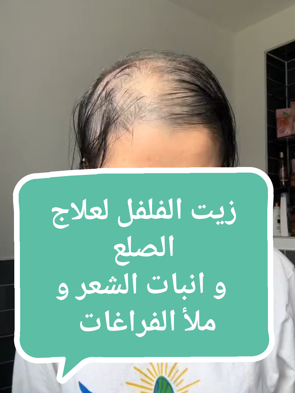 الزيت لي انقد شعرها من الصلع و ملأ الفراغات بشهر واحد✅✨ #علاج_الصلع #تساقط_الشعر #fyp #اكسبلور #انبات_الشعر 