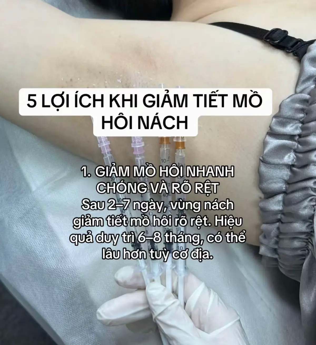 Những điều bạn cần nên biết đến#linhminfiller #filler #botox 