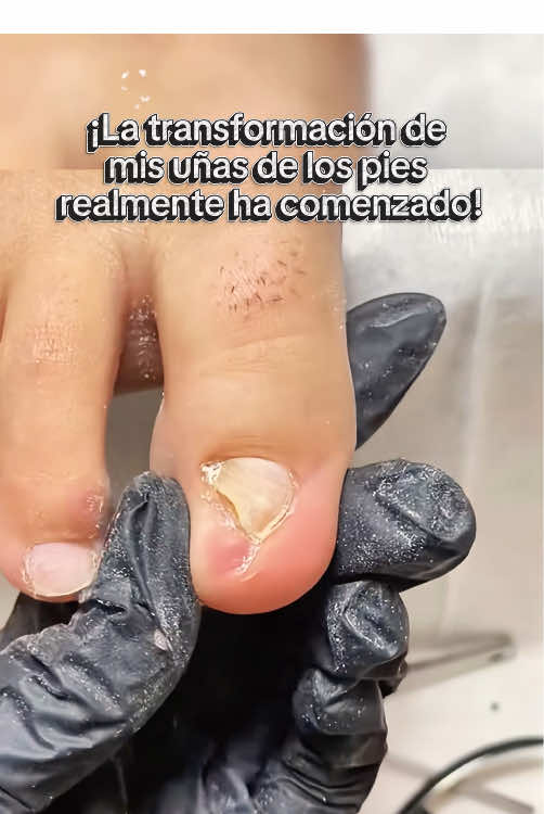 ¿ Cómo no voy a limpiarme los pies? Solo hice un paso.#nailcare #tiktokmademebuyit #toenails #tiktokshop #gainknowledge 