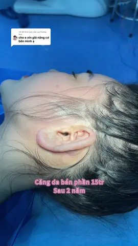 Trả lời @Lan Hương Spa  căng da mặt sau 2 năm #cangdamat #BsHoangduy #reviewlamdep #reviewlamdep❤️ #phunuthichlamdep 