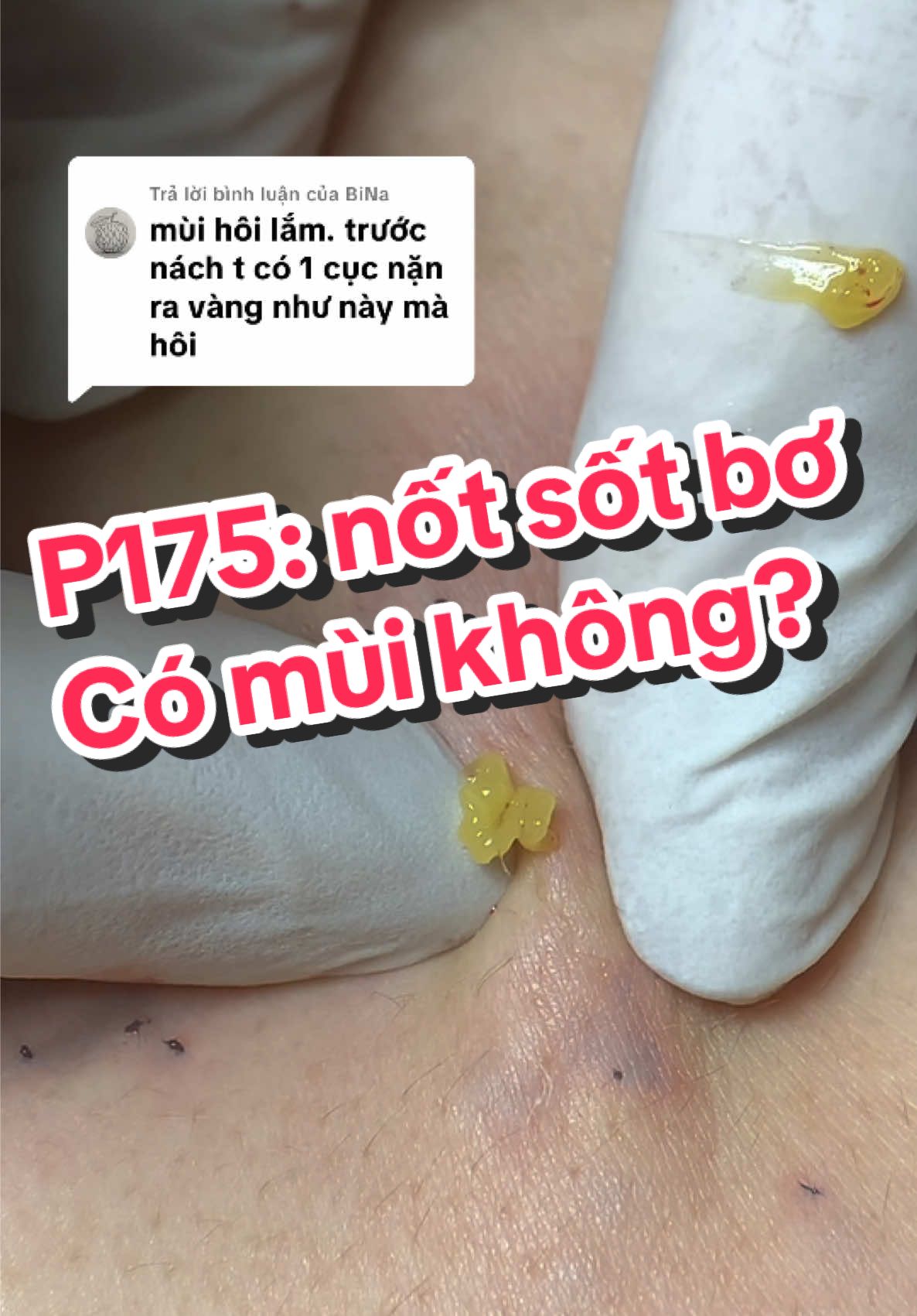 Trả lời @BiNa #phunglananhnanmun #daotaospa #unangtuyenba #munsotbo #nanmunthanhxuan 