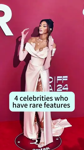 #celebrities #fyp 