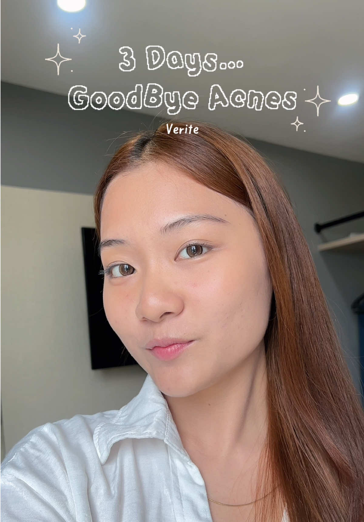 หน้าฝน = สิวเห่อไม่รู้ตัว 😭 แต่มูฟออนได้ง่าย ๆ หน้าสดก็มั่นใจได้ #NoFilterNeeded เพราะมี เซตจุลินทรีย์เคลียร์สิว ช่วยยับยั้งสิวด้วย Pre-Probiotic ผิวใสขึ้นจริง 💙 📌 พิเศษใน TikTok Shop ลดแรง + โค้ดลูกค้าใหม่ กดตะกร้าด้านล่างได้เลย 🛒 #veritethailand #เวอริเต้ #โฟมจุลินทรีย์  #เจลแต้มสิวจุลินทรีย์ #โฟมล้างหน้าVerite #เจลแต้มสิวVerite