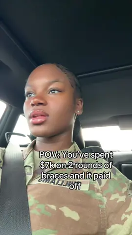 AW YES 32 porcelain veneers. 🤣🤣 #army #fyp 