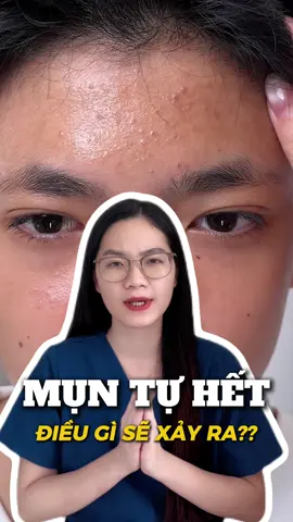 Điều gì sẽ xảy ra nếu để cho mụn dậy thì tự hết? #ylee, #suaruamatylee #trimun #duocsinguyentrang #songkhoe247♥️ 