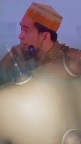 #terapibekam 