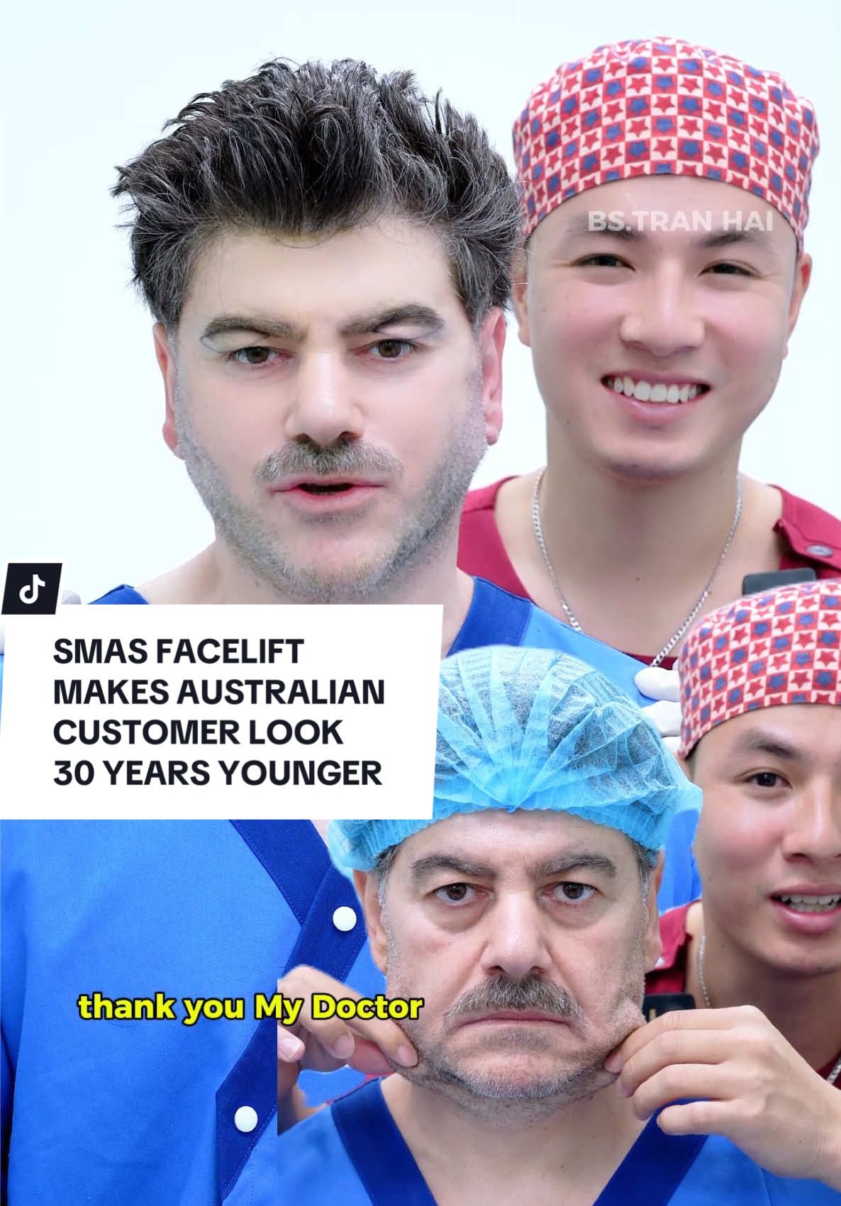 SMAS FACELIFT MAKES AUSTRALIAN CUSTOMER LOOK 30 YEARS YOUNGER #facelift #facelifting #xuhuong #xuhuongtiktok #australia 