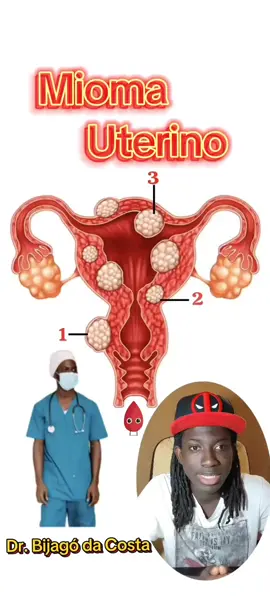 @BRAIMA_B.S @Ampa Djata Djedjo @Kitāb al-Qānūn @TRIBO DE RAINHAS 245 @Ima lyon @vidalanhampadju @Dollas #medicalstudent #videoviraltiktok #tiktokguinebissauportugal🇬🇼🇵🇹 #tiktokpalop🇬🇼🇧🇷🇨🇻🇦🇴🇸🇹🇲🇿🇵🇹 #tiktokpalopmidia🇬🇼🇧🇷🇨🇻🇦🇴🇸🇹🇲🇿🇵🇹 