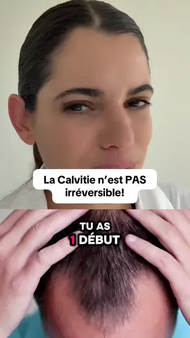 NON la calvitie n’est pas irréversible! Télécharge gratuitement mon guide je t’explique comment la freiner. Écris « GuideAG » en commentaire et je t’envoie le lien 🔗 