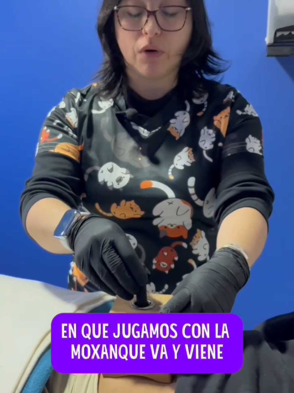 #moxibustion #adenomiosis #infertilidad  #medicinaalternativa  el video por fin! de cómo auto aplicarse moxa, y así ayudarse con el dolor que provoca la #endometriosis 