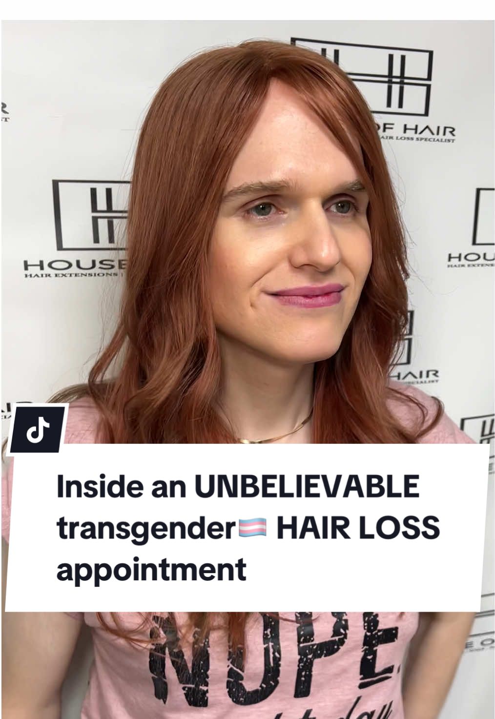 This isn’t a wig… it’s mesh integration 👀 Aida’s hairline was transformed in just one appointment from wigs that never felt natural, to a breathable, secure system that looks and feels like her own hair. ✨ Confidence restored. Transformation complete 😍 💬 Want to see more life-changing results like this? Hit follow for real transformations + insider tips on advanced hair loss solutions. #MeshIntegration #transgender #hairlossspecialist #androgenicalopecia #hairlosssolutions  
