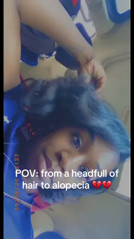Updateee!!! A ho still baldheaded. Going through old pictures & videos breaks my heart because I’ve had hair since I came out the womb. I’ve never had a “I’m bald because my mom permed my hair” moment. I’ve had a headfull, eyebrows full too. Never needed to tint them things, color them in .. none of that. Now we are here.. loosing hair by the second. But IM STILL THAT GIRLLL just with shorter hair & thinner eyebrows. Someone help meeee, send me some tips and tricks to reverse this sh!t!!! #alopeciaawareness 
