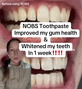 Nervous posting this, but I am so thankful to have heard of NOBS toothpaste.. I will never go back, I am starting to gain confidence back in my smile.  #nobstoothpaste #gumhealth #whiteteeth #toothpaste #MomsofTikTok 