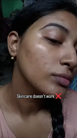 📞 For Order Contact: 0340 4242458 #skincare #skincareroutine #skincarelovers #skincareaddict #skincaretips #glowingskin #clearskin #SelfCare #skincarecommunity #skincareproducts #healthyskin #skincarejunkie #beautyroutine #skincaregoals #naturalskincare #skincareblogger #antiaging #acneprone #acnetreatment #facialcare #moisturizer #serum #spf #skincareluxury #GlowUp #skincareobsessed #koreanskincare #skincarelife #skincareenthusiast #dermacare 