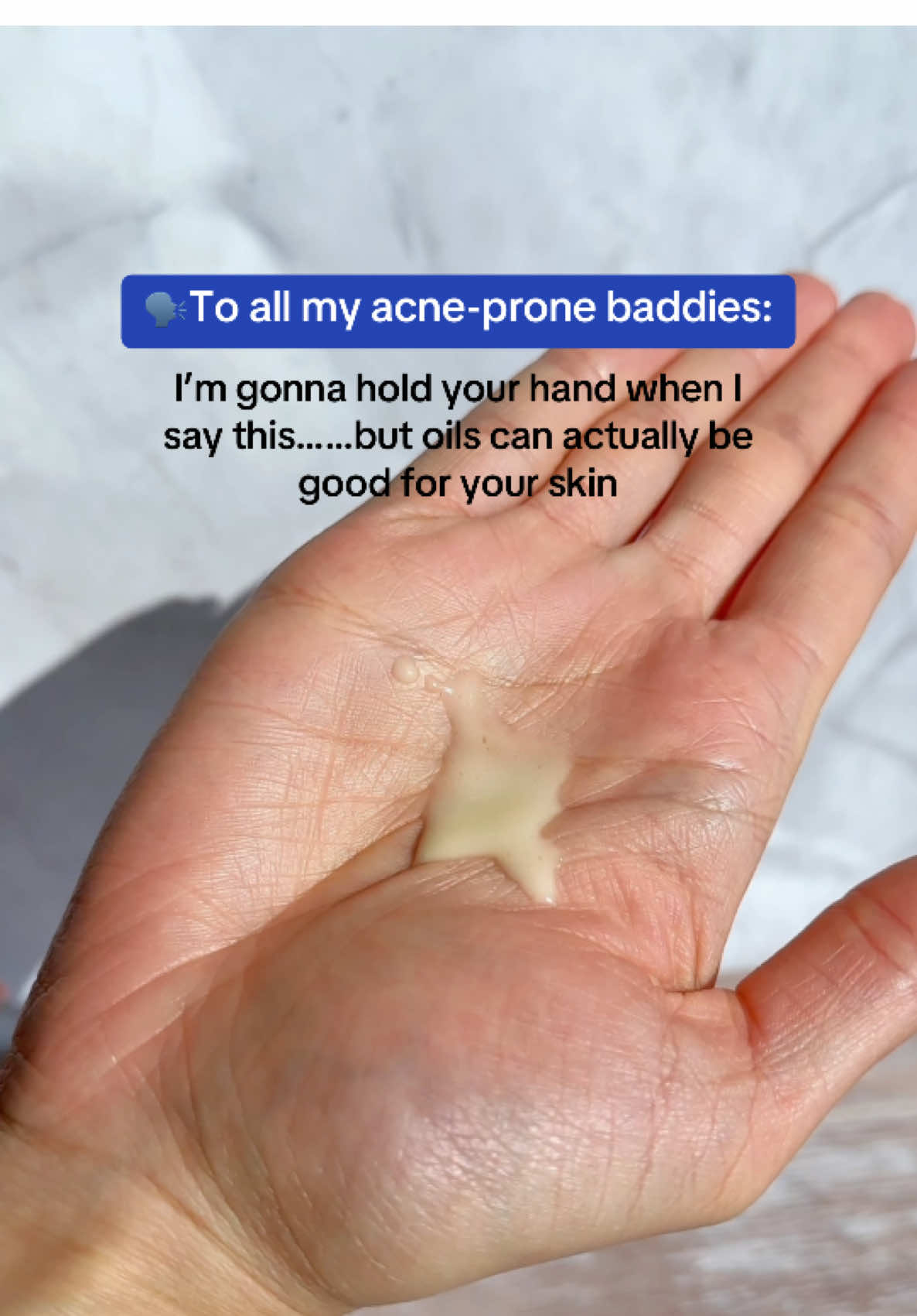 Oils are NOT the demons you think they are! @KraveBeauty  🤍Kravebeauty Oil La La Serum  • for Acne, Breakouts, oily skin • Supports Skin Barrier Health • Suitable For Sensitive Skin #kravebeauty #acneproneskin #serum #TikTokShopCreatorPicks #summersfinalsprint 
