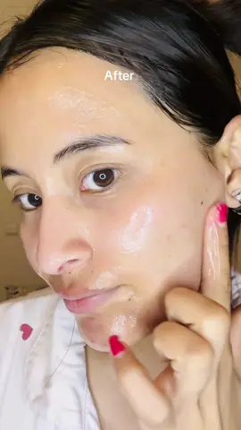 Day 2 with the @Arencia  Arencia Red Smoothie Serum 30 🍓✨ Loving how fresh + lightweight it feels on my skin!  #pores #glowingskin #collagenboost #antiaging #arencia 