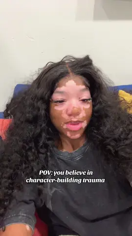 #fyp #vitiligo 