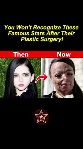 You Won’t Recognize These Famous Stars After Their Plastic Surgery! #usa #hollywood #celebrities #celebrity #plasticsurgery 