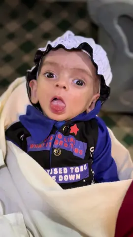 Day Update – Baby Abubakar 💙 Today Baby Abubakar is going for his surgery checkup in Peshawar. Doctors will examine him and decide if surgery is needed. Please keep him in your prayers 🙏 📌 Support & Donations Bank Transfer: • Account Title: Umair Khan • Bank: Allied Bank • IBAN: PK20ABPA0020064194360031 • SWIFT Code: ABPAPKKA PayPal: 📧 ujabir3@gmail.com Your prayers and support mean everything. Together we can bring hope to Baby Abubakar’s life 💙 #BabyAbubakar #SurgeryCheckup #PrayersForBaby #RoyalNurseryUnit