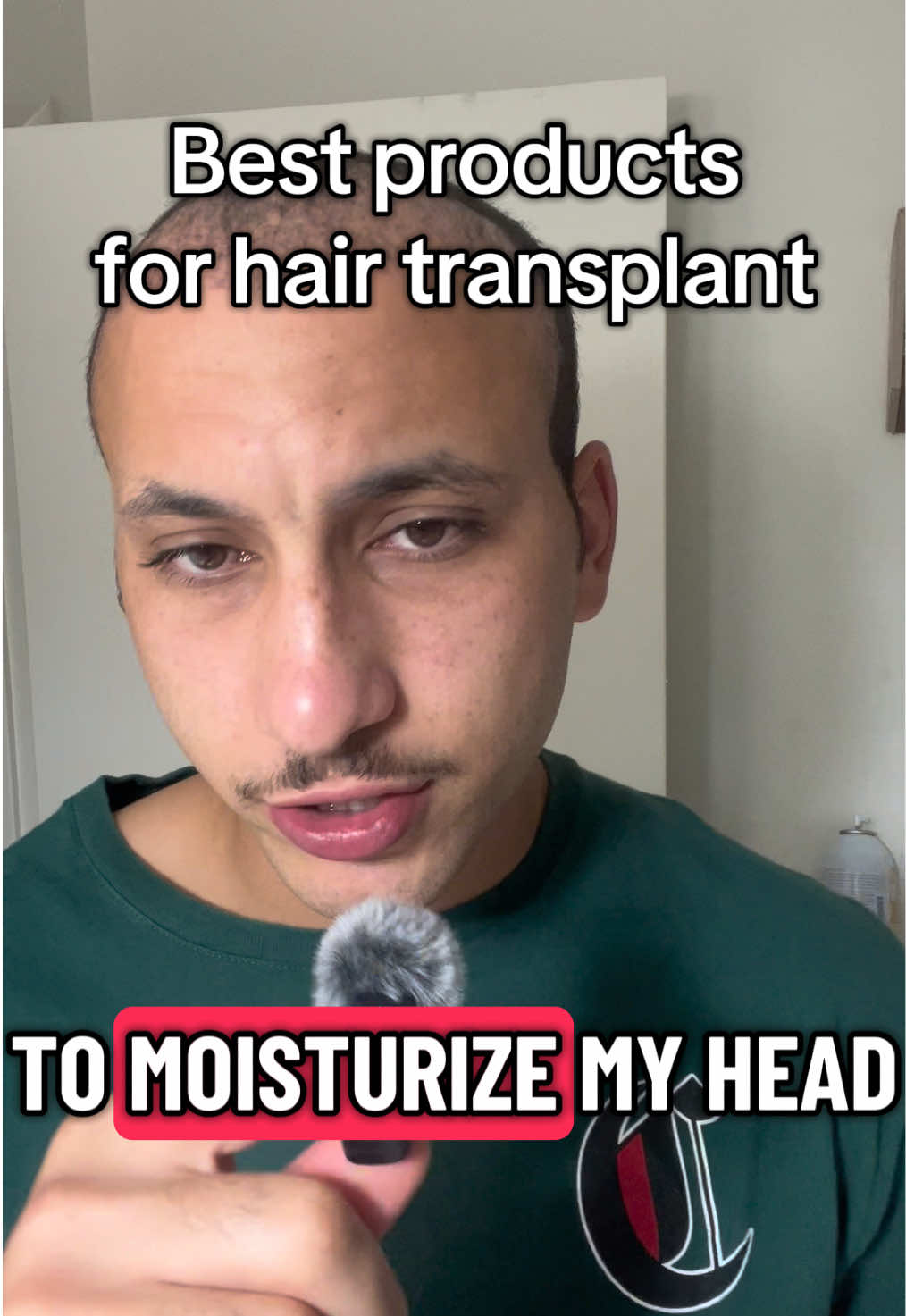 Sorry it wouldn’t let me add the baby lotion 🥲 #hairtransplant #hair #fyp #