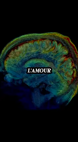 L'amour obsessionnel active les mêmes circuits que l'addiction. #neuroscience #pourtoi #psychologie #cerveau #amour 