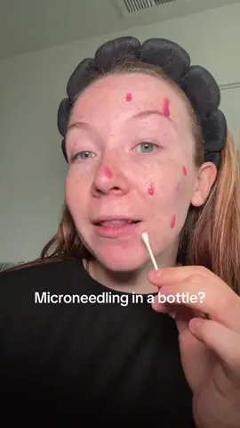 This Dr melaxin pink spicule bundle is microneedling in a bottle - no needles, no downtime. 1000 spicules gently penetrate the skin to help smooth, tighten, and refine texture while strengthening your barrier.  #spiculeserum #microneedlinginabottle #glassskinroutine #drmelaxin #biohackingbeauty