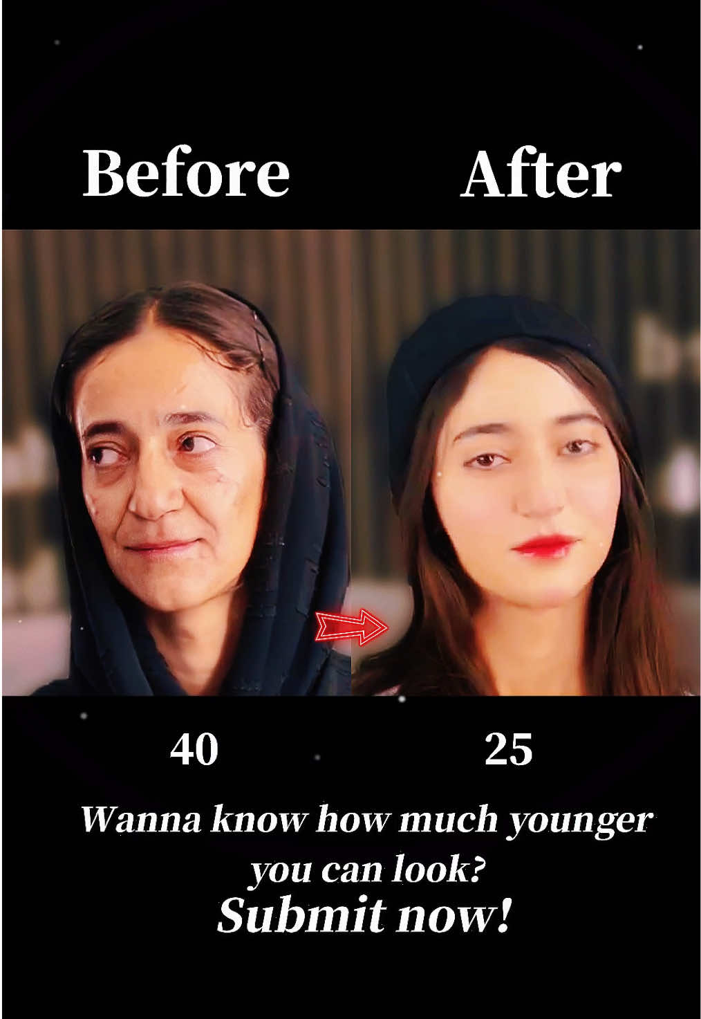 Youth Restored, Confidence Boosted #Facelift #FaceLifting #AntiAging #YouthfulSkin #WrinkleFree #SkinTightening #GlowUp #BeautyTransformation #SkincareRoutine #AgelessBeauty #拉皮手术 #面部提升 #逆龄 #年轻无敌 #جمال_الشباب #شد_الوجه #بشرة_صافية #تجميل #سر_الجمال #العناية_بالبشرة 