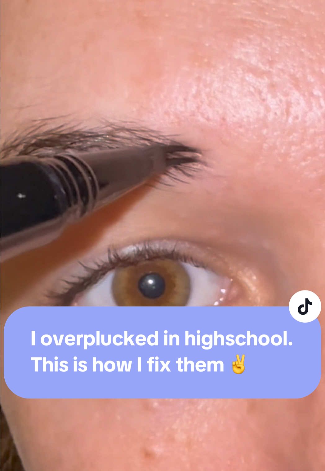 Anyone else overpluck their eyebrows in highschool? Yeah same… I’ve been using this eyebrow pen for months! #eyebrowpen #eyebrowtutorial #eyebrows #makeup #eyebrowmakeup 