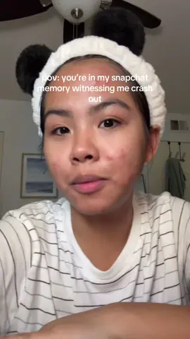 thought i should hop on this trend LMAO #tiktoktrend #hormonalacne #crashoutmusic #relatable #fyp 