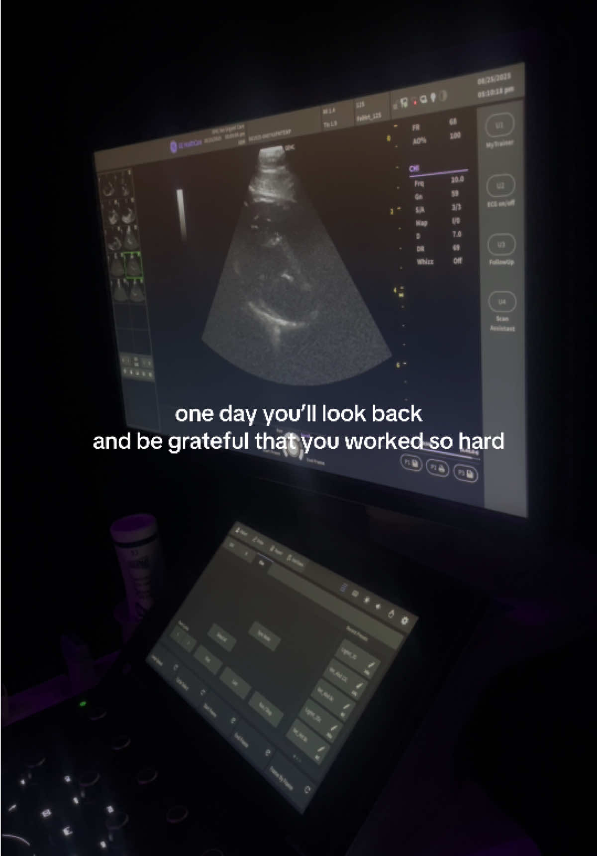 the only thing stopping you is you 🫀 #anatomy #healthcare #sonographystudent #sonography #StudyTips 